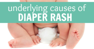Underlying Causes of Diaper Rash